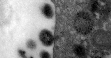 Covid-19: anticorpos podem durar até 12 meses após infecção, diz pesquisadores